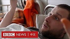 烏克蘭一家遭集束炸彈襲擊 永遠背著「戰爭的傷痕」－ BBC News 中文