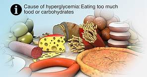 Treating High Blood Sugar | Hyperglycemia | Nucleus Health