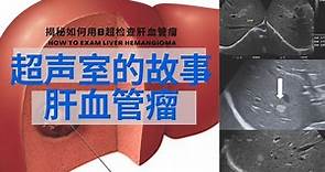 肝血管瘤 ： 肝血管瘤是什么/病因/危险人群/常见症状/超声是如何检查/治疗方法【Ultrasound Room】Liver Hemangioma
