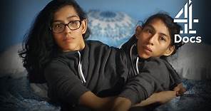 Conjoined Twins on Heartbreaking Difficulty of Being Immigrants in America | Two Sisters, One Body