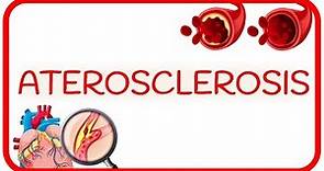 ATEROSCLEROSIS - causas, fisiopatología y factores de riesgo