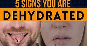 5 Signs You Are Dehydrated | How To Know If You Are Dehydrated