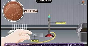 Gram Staining Procedure Animation Microbiology - Principle, Procedure, Interpretation