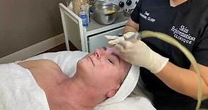 Microdermabrasion Facial Demonstration