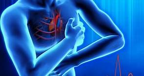 心肌梗塞：原因、症状、诊断和治疗