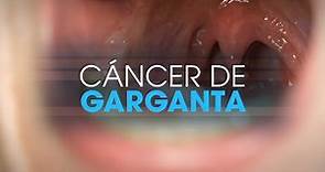 Cáncer de garganta | Pacientes TV