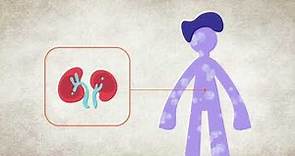 High Potassium (Hyperkalemia) - Symptoms & Causes | National Kidney Foundation