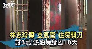 【TVBS新聞精華】20200920 林志玲傳"支氣管"住院開刀 討3萬!熱油燒身囚10天