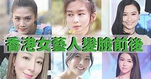 23位香港女星整容前後 原來她她她也有變臉？成功vs失敗案例