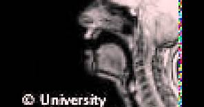 MRI voiced velar nasal