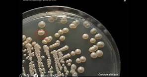Candida albicans- culture, pathogenesis and laboratory diagnosis