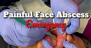 We Drain a Painful Facial Abscess in a Teenager