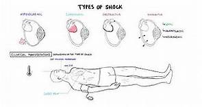 Approach to Shock - types, hypovolemic, cardiogenic, distributive, anaphylaxis, pathology, treatment