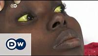 Yellow fever epidemic spreads in Angola | DW News