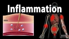 Inflammatory Response, Animation