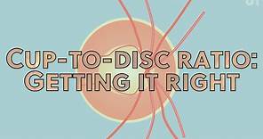 Cup-to-disc ratio: getting it right | OT Skills Guide