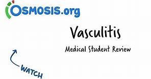 Vasculitis | Clinical Presentation