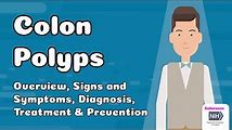 Colon Polyps: What You Need to Know to Prevent Colon Cancer