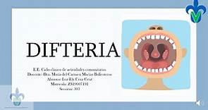 ¿Qué es la difteria?