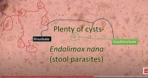 Parasitology/Endolomax /E nana in stool sample under the microscope