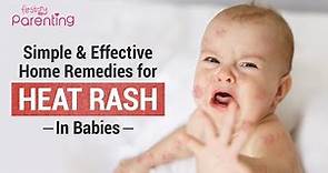 8 Simple Home Remedies for Heat Rash On Babies