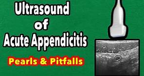 Ultrasound of Acute Appendicitis: Pearls and Pitfalls