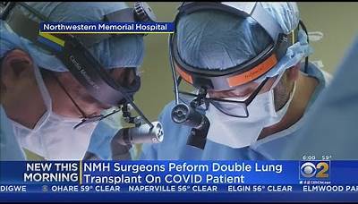 Surgeons Perform Double Lung Transplant On COVID-19 Patient At Northwestern Memorial Hospital