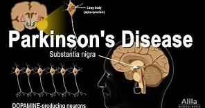Parkinson's Disease, Animation