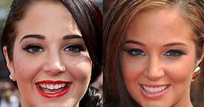 Celebrity Teeth: Before And After