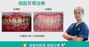 【晨光牙醫診所】微創牙周治療，牙周病案例分享｜徐振祥醫師