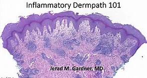 Inflammatory Dermpath 101 (A Beginner's Guide to Diagnosing Skin Rashes for Non-Dermatopathologists)