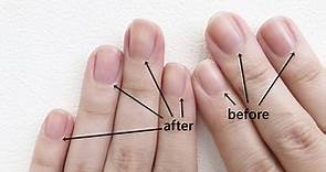 【保養知識王】日常「剪指甲」最常遇到的5個問題一次解答！什麼時候剪最好？長度要剪到多長？指緣硬皮怎麼處理？