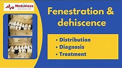 Fenestration and Dehiscence l Periodontal anatomy l Mediklaas