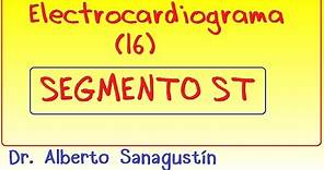 Electrocardiograma (16): Segmento ST