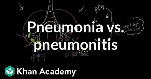 Pneumonia vs. pneumonitis | Respiratory system diseases | NCLEX-RN | Khan Academy
