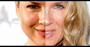 Renee Zellweger Before And After | Then And Now | Changing Face