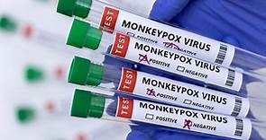 猴痘入侵台灣！傳染途徑、潛伏期一次看　4種藥物可用於治療 | ETtoday生活新聞 | ETtoday新聞雲