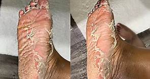 I TRIED A CRAZY FOOT PEEL MASK *INSANE RESULTS* 😳😳😳
