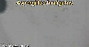 Aspergillus niger, fumigatus and flavus
