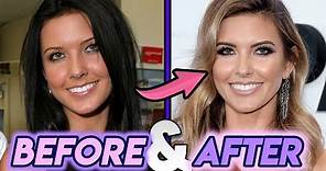 Audrina Patridge | Before and After | The Hills Star Plastic Surgery Transformation