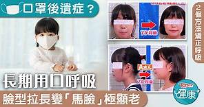 【口罩後遺症】長期用口呼吸臉型拉長極顯老　日本節目教2個方法矯正呼吸 - 香港經濟日報 - TOPick - 健康 - 保健美顏