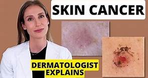 Dermatologist Explains Skin Cancer: Different Types, Causes, Prevention & Treatments | Dr. Sam Ellis