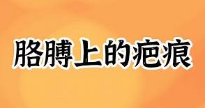 为什么几乎每个人胳膊上都会有一个疤痕？‖卡介疫苗‖牛痘（天花）疫苗