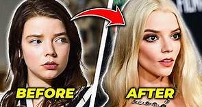 The DARK Truth Behind Anya Taylor Joy’s Face Transformation!