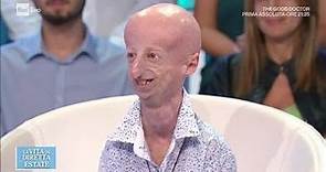 Sammy Basso, dalla lotta alla progeria alla laurea con lode - La vita in diretta estate 24/07/2018