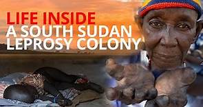 Rare look inside a Leprosy Colony in South Sudan | EWTN News In Depth