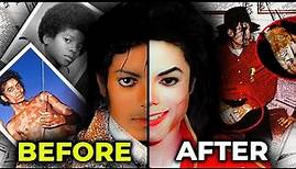 The REAL Reason Why Michael Jackson's Skin Turned White | MJ Forever