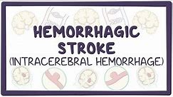 Hemorrhagic stroke: intracerebral hemorrhage - causes, symptoms, diagnosis, treatment, pathology