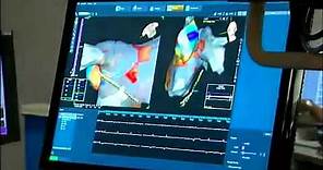 3-D Electrical Mapping of the Heart