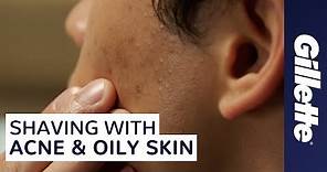 How to Shave with Acne and Oily Skin | Men's Skin Care Tips